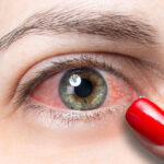 নারীদের চোখের যে রোগগুলো বেশি হয়
